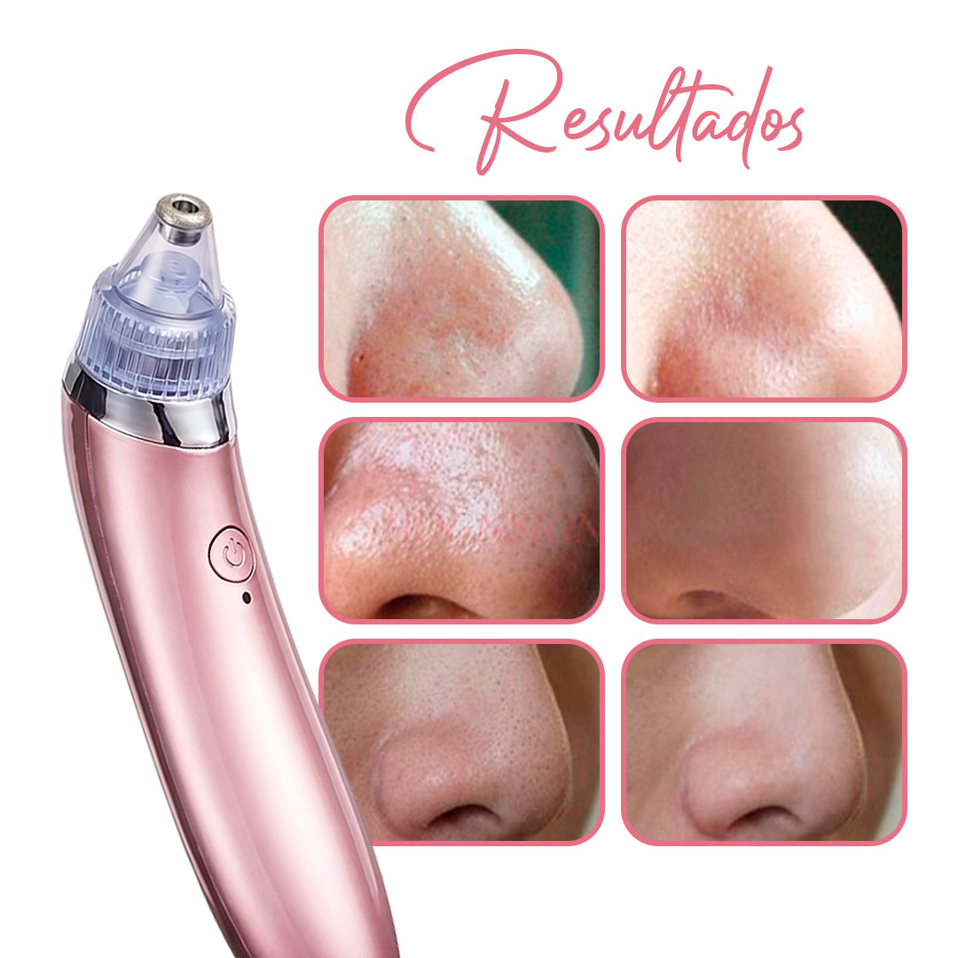 Limpiador Facial de Poros, Limpieza Profunda en Casa | Skin Care XN-8030
