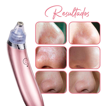 Limpiador Facial de Poros, Limpieza Profunda en Casa | Skin Care XN-8030